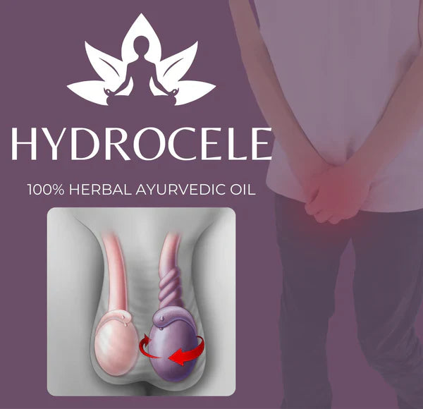 Hydrocele Ayurvedic Oil 🔥