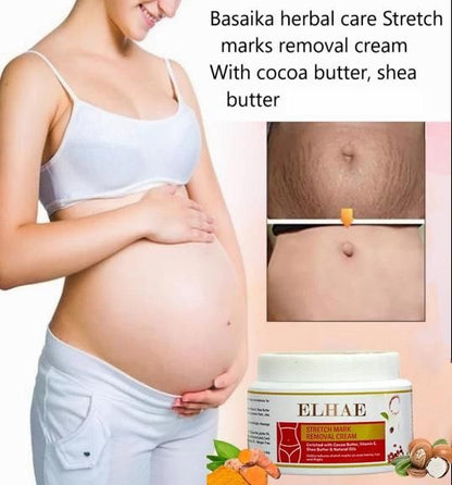 Stretch Mark Removal Cream