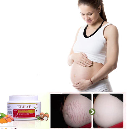 Stretch Mark Removal Cream